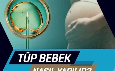 Tüp Bebek Tedavisi için Nasil Ve Ne Zaman Hazir Olmalıyim? 8 Tüp Bebek Tedavisi için Nasil Ve Ne Zaman Hazir Olmalıyim?
